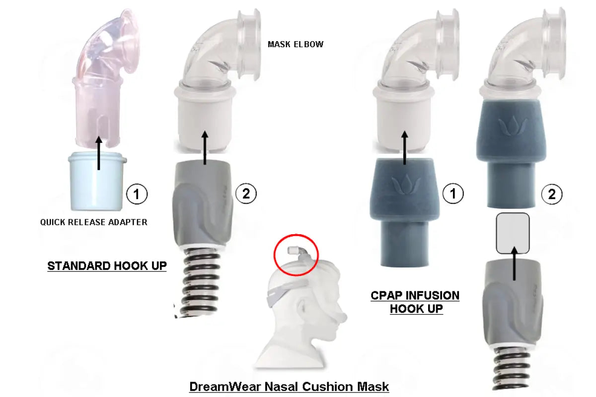 CPAP Essential Oil Infusion Adapter with 4 Diffusion Pads